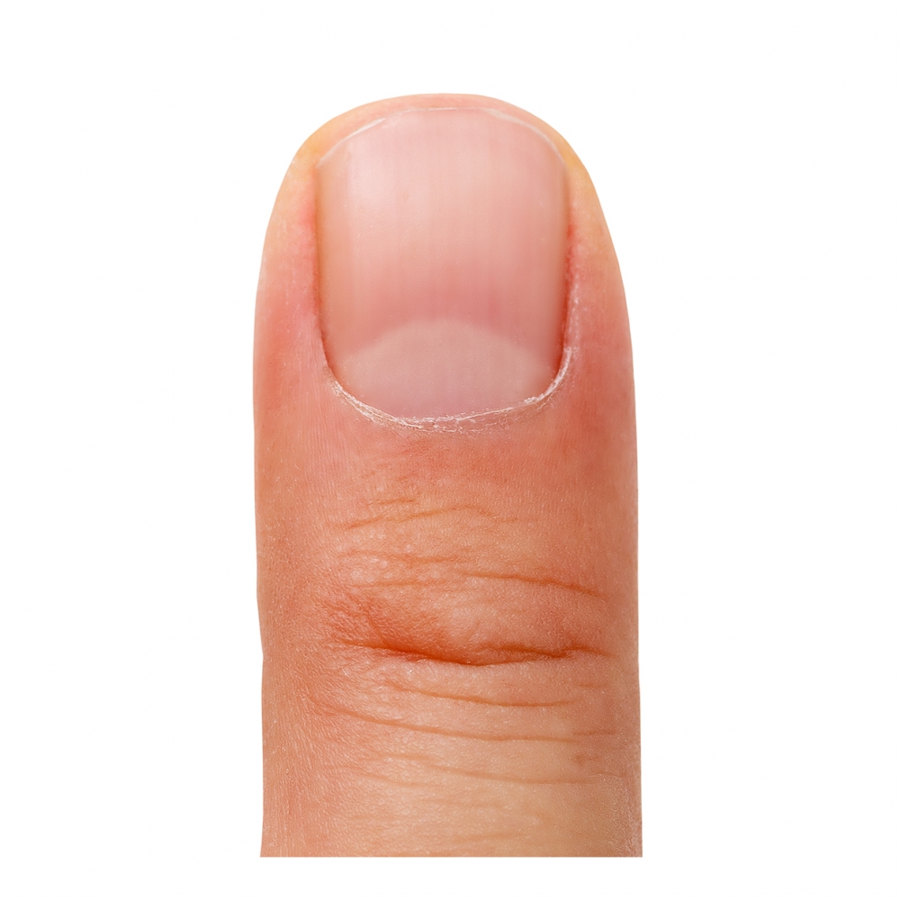 Imagen en la que se ve una uña en un dedo
