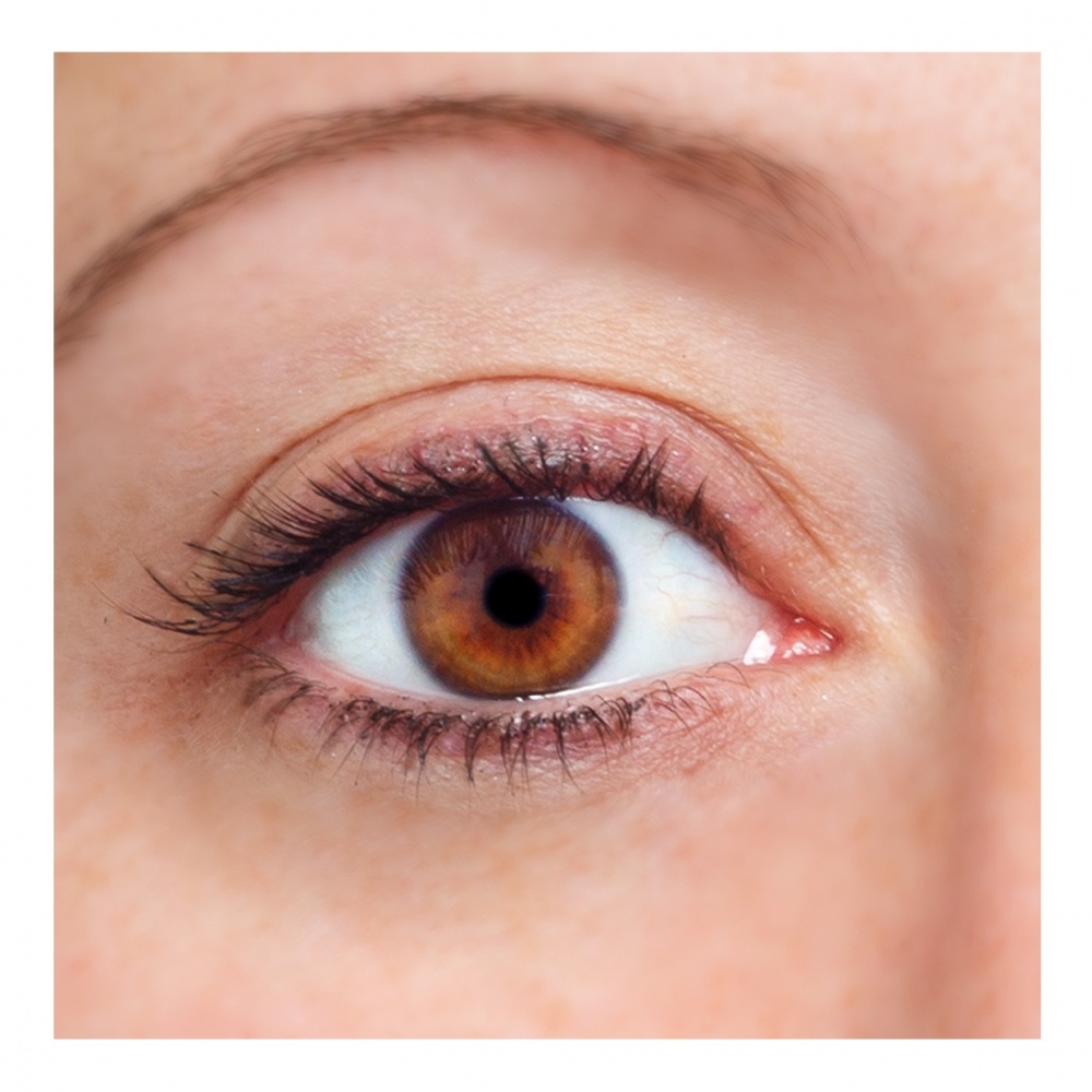 Imagen en la que se ve un ojo