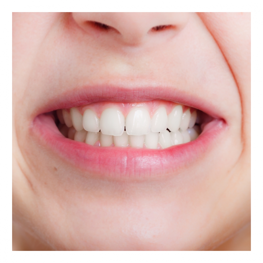 Imagen en la que se ve los dientes de una boca