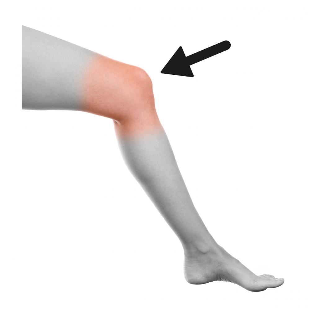 Imagen en la que se ve una rodilla