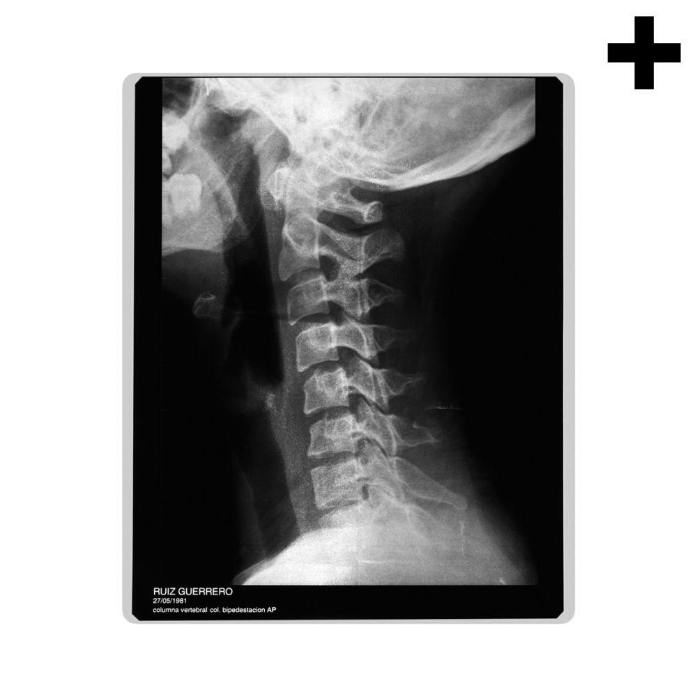 Imagen en la que se ve el plural del concepto radiografía