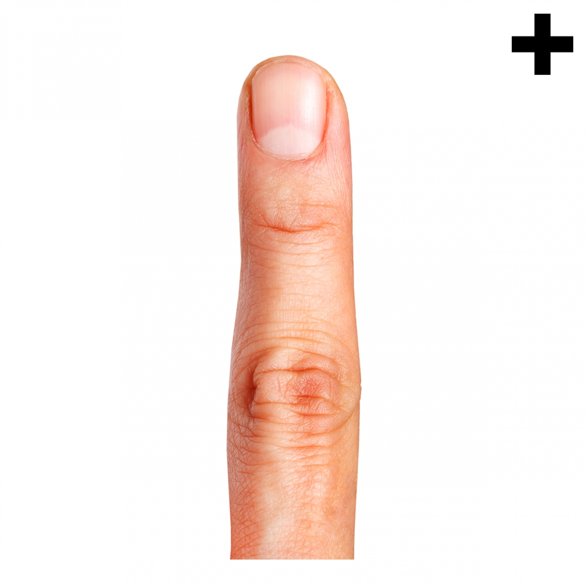 Imagen en la que se ve el plural del concepto dedo