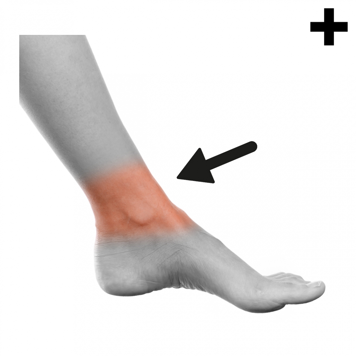 Imagen en la que se ve el plural del concepto tobillo