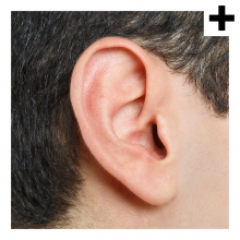 Imagen en la que se ve el plural del concepto oreja