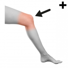 Imagen en la que se ve el plural del concepto rodilla